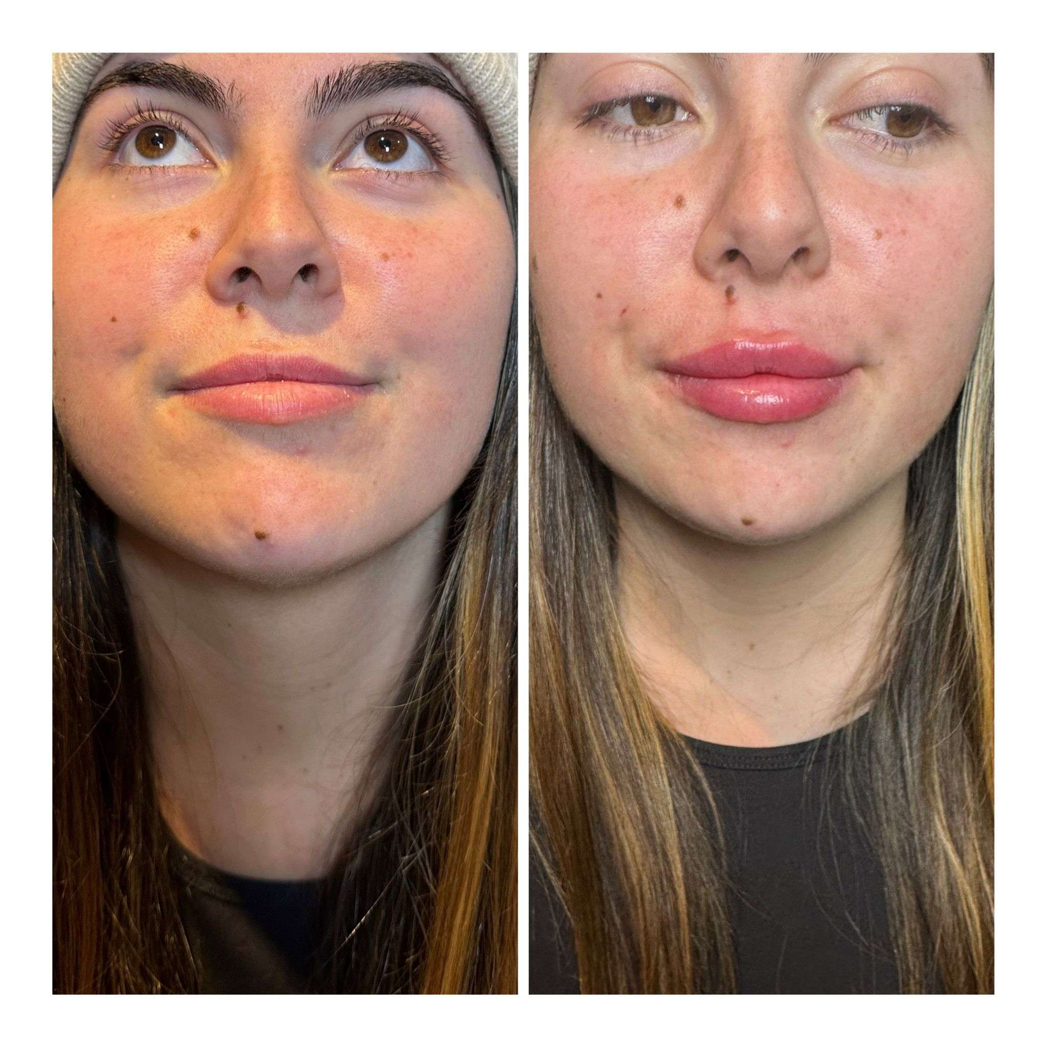 Anti-Aging Care