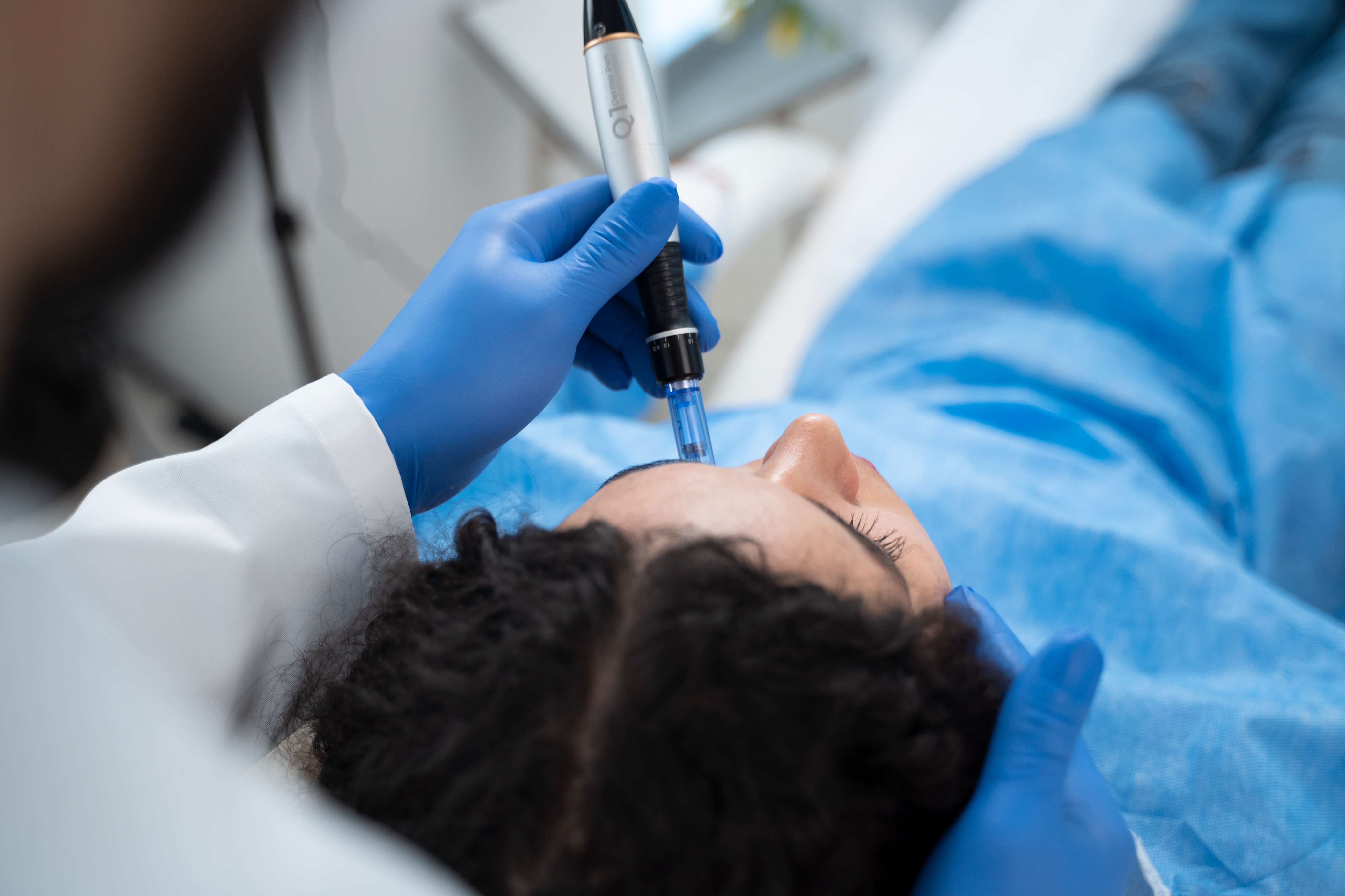 Radio Frequency Microneedling