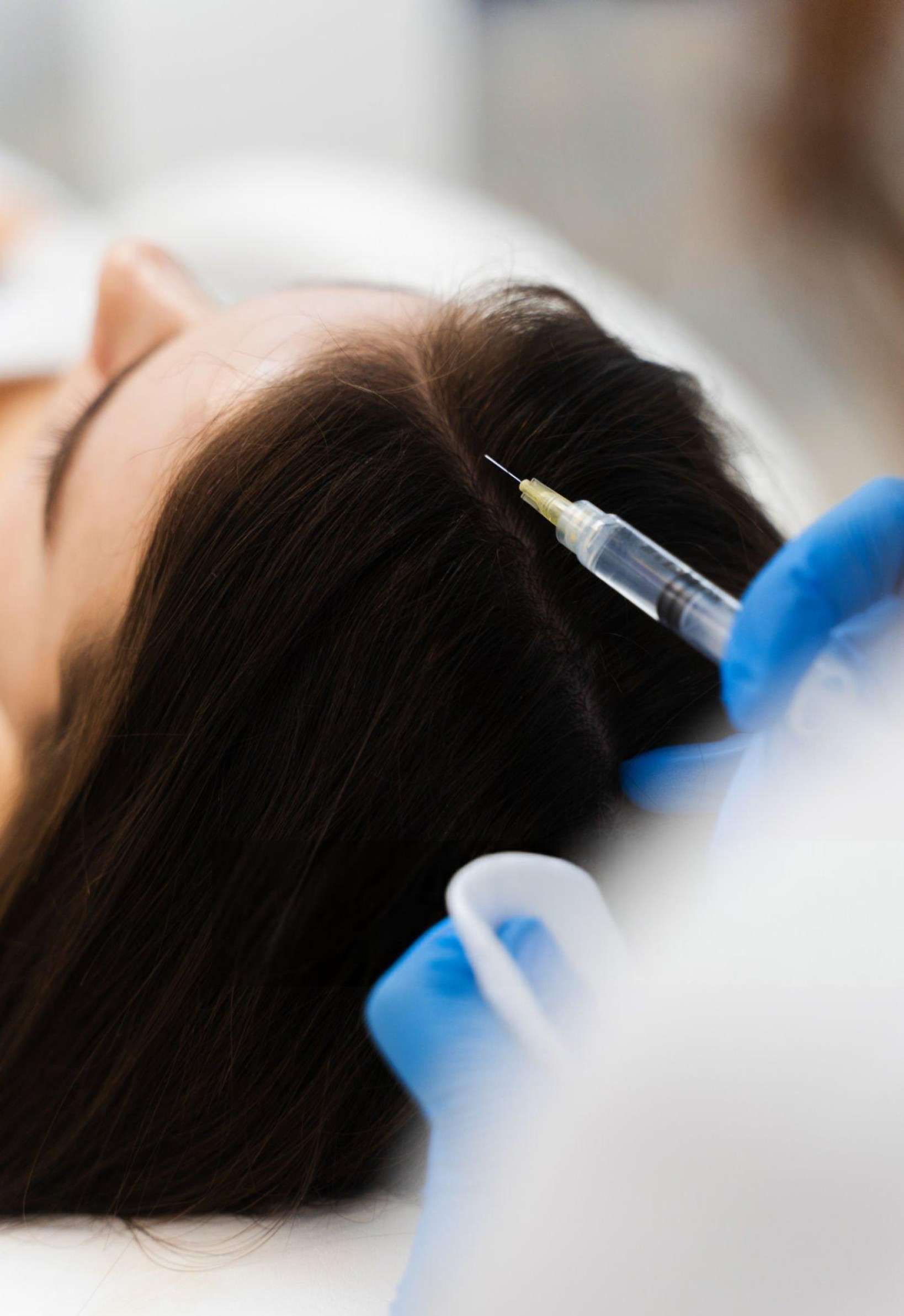 Prescription Hair Treatments